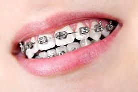 Behel Metal Premium